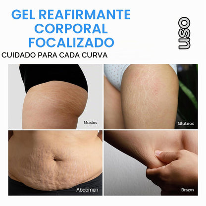 Cryo Thermo - Crema tensora de celulitis para el cuerpo